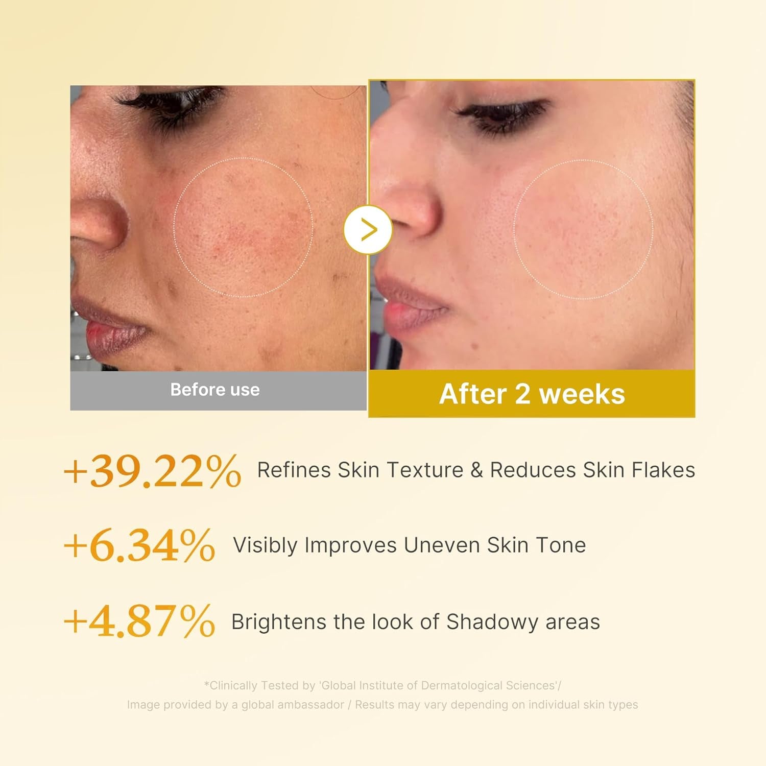 Kojic Acid Turmeric Smoothing Toner for Face & Body | Lightweight Toner for Balancing Uneven Skin Tone & Texture | Niacinamide, Glycolic Acid for Clear Glass Skin | 8.45 Fl.Oz